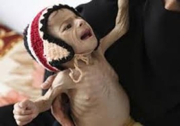 Child Nutrition Support